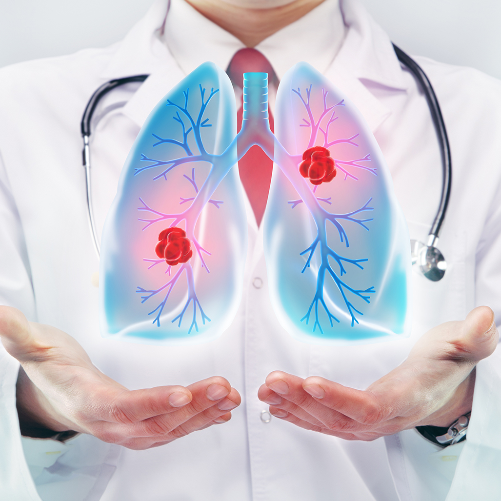 What Are Breathing Disorders?